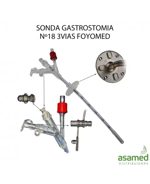 SONDA GASTROSTOMIA Nº18 3VIAS FOYOMED